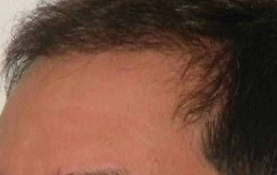 After image